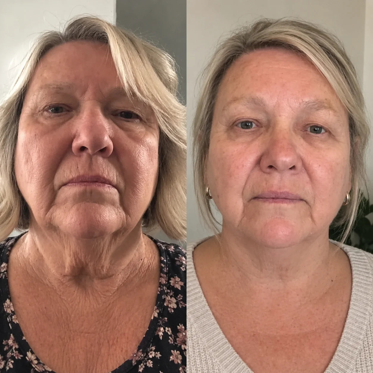 NAVIDA customer result