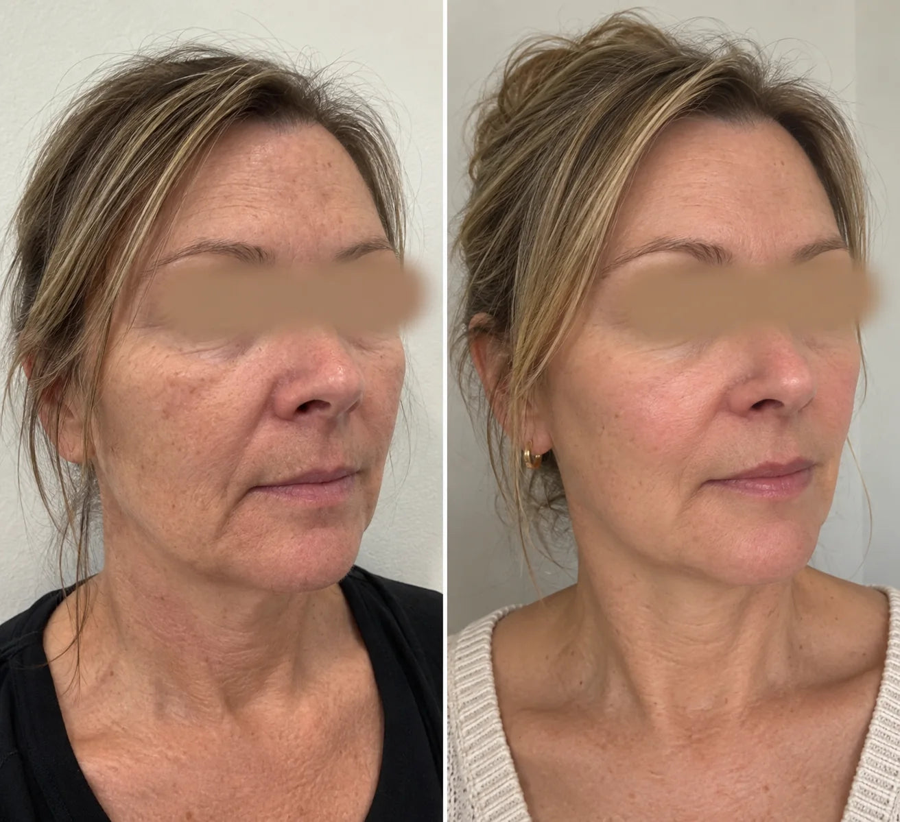 NAVIDA customer before consistent use